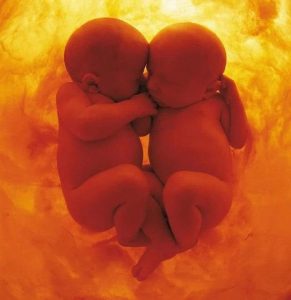Two babies.